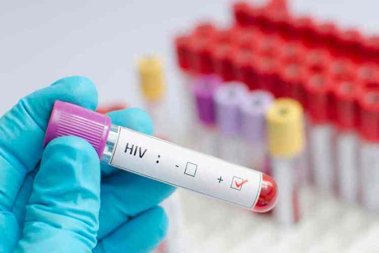 Una mujer en España se convierte en un caso único de curación funcional del VIH y abre nuevas vías de investigación