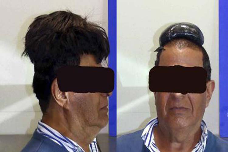 Detenido colombiano en España con cocaína oculta en su peluquín