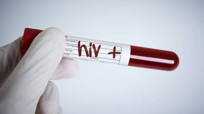 Peligroso reto viral incita a relaciones sexuales con pacientes VIH (+Detalles)