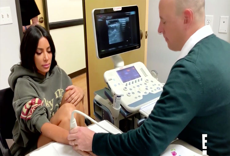 Kim Kardashian West dio positivo a anticuerpos asociados con el lupus