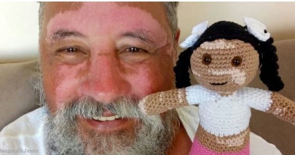 Abuelo brasileño con vitiligo crea muñecas para promover la inclusión