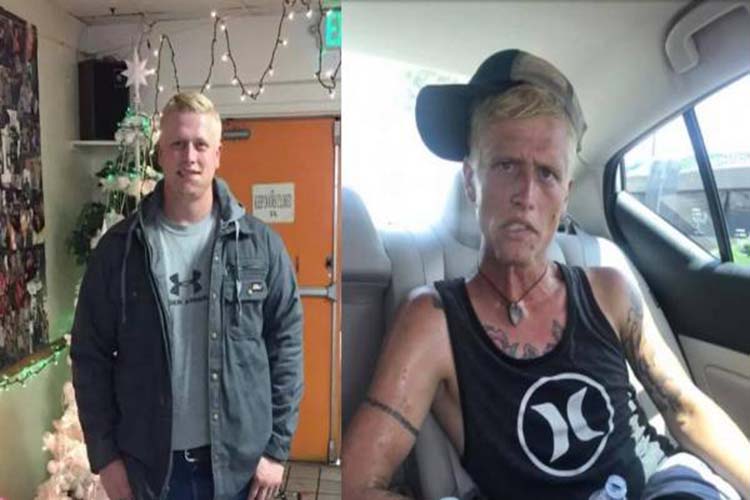 “La cara de la metanfetamina”: Las fotos que compartió la madre de un adicto para mostrar su transformación