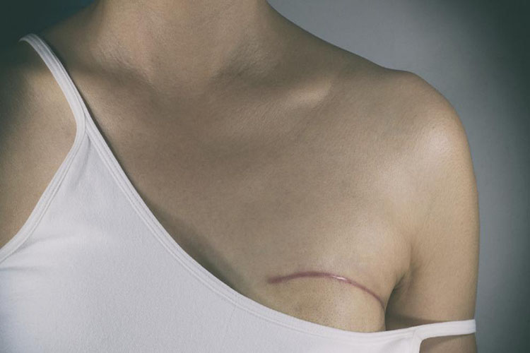 Prosperi: Viene un repunte de osteoporosis y cáncer de mama