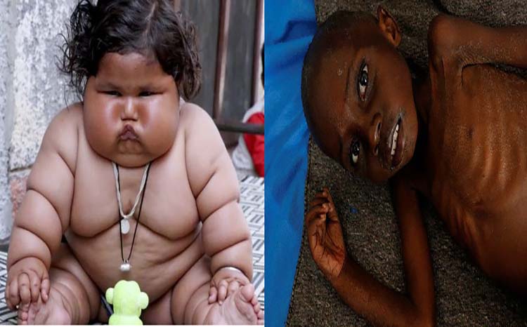 Unicef señala que uno de cada tres niños está desnutrido u obeso