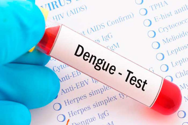 Podrán detectar el dengue a través de un test con nueva estructura de ADN