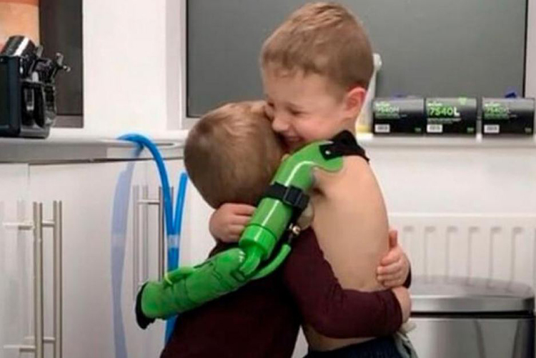 Niño le dió un tierno abrazo a su hermanito con su nueva prótesis