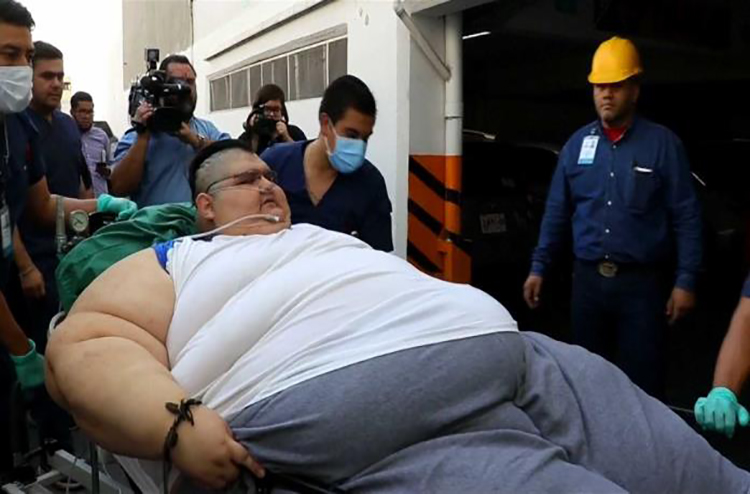 El hombre más gordo del mundo cambió su vida al perder 330 kg