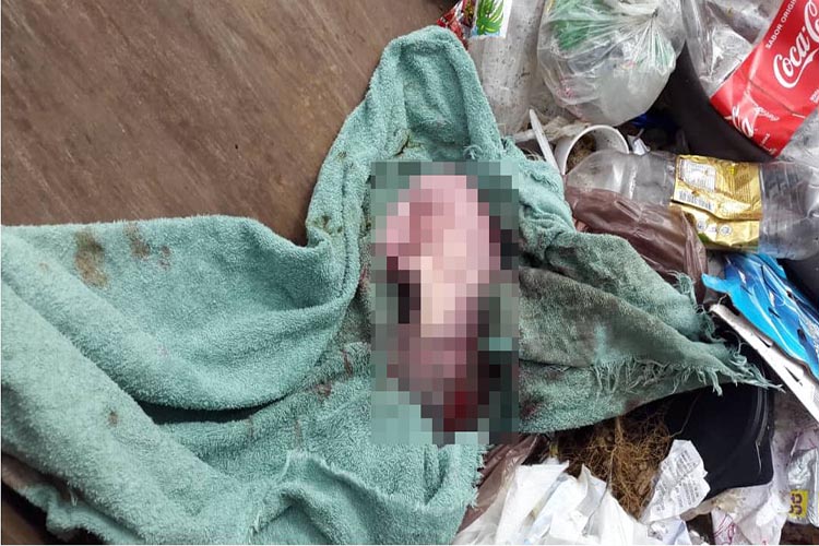 FOTOS| Localizan a un neonato fallecido en contenedor de basura en Bellas Artes