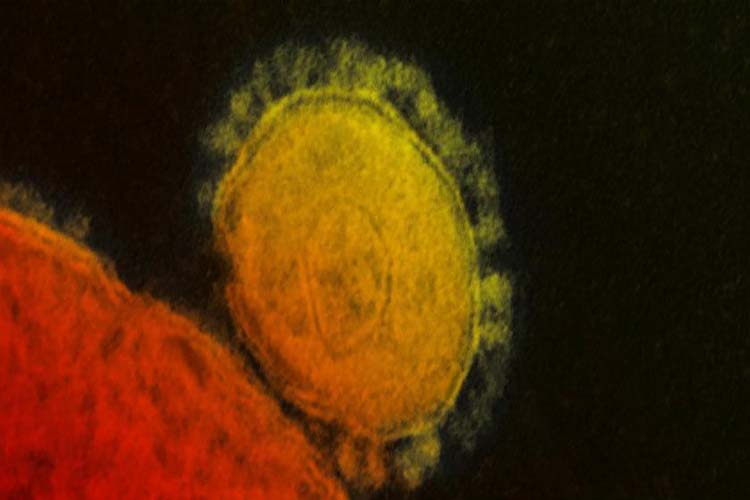 Lo que debes saber del coronavirus (+Causas y síntomas)