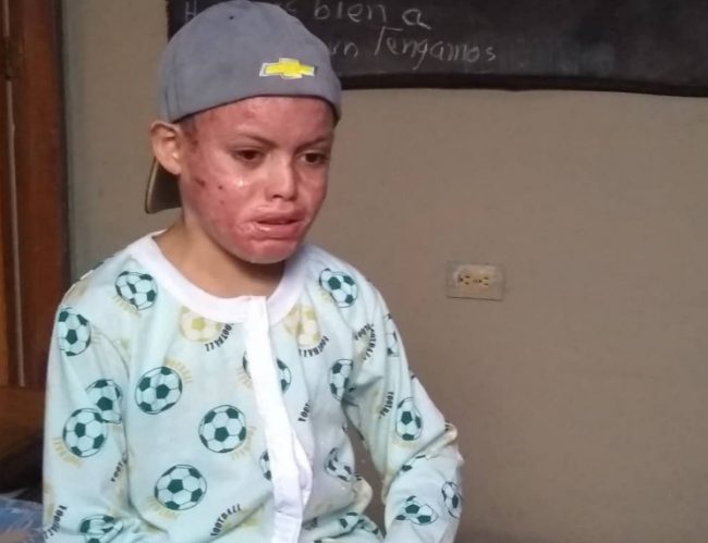 Niño envía mensaje de esperanza tras sobrevivir a las llamas