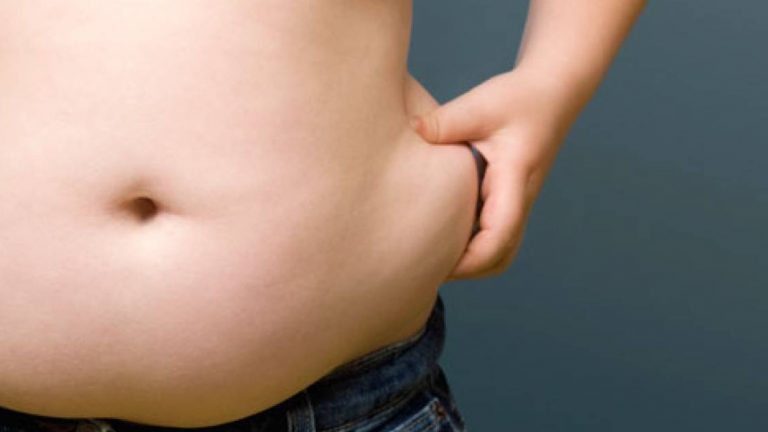 La obesidad es factor de riesgo frente al COVID-19, según especialista