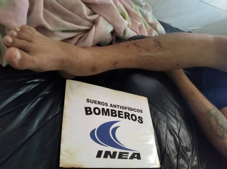 Niña de 12 años muere por mordedura de serpiente en Mérida (+Dos heridos)