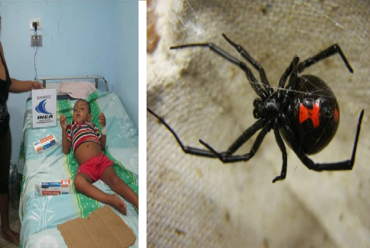 Niño de cinco años fue mordido por una araña «Viuda Negra»