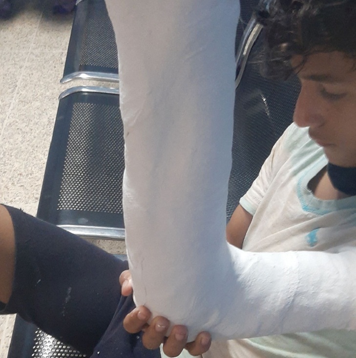 Servicio Público: Adolescente requiere ayuda por fractura en el brazo