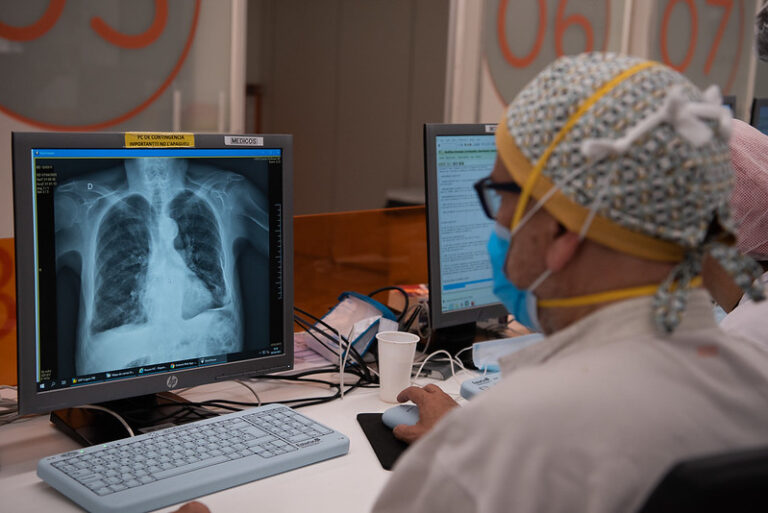 Un tercio de ingresados por covid presentan cambios pulmonares un año después