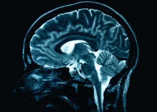El covid-19 altera el volumen de materia gris en el cerebro, según estudio