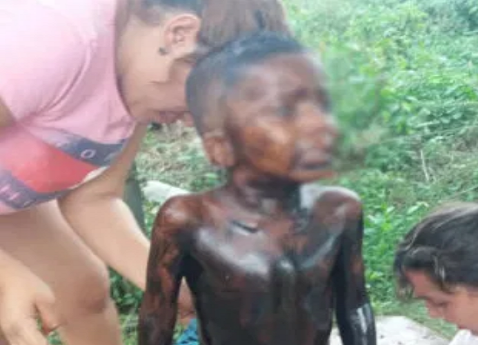 Niño cayó en un pozo de petróleo en el Zulia