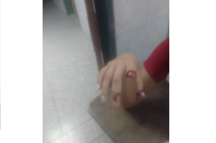 Delincuentes le cortan tres dedos a estudiante de la UNES