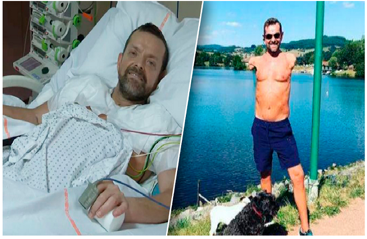 Hombre que recibió trasplante de brazos en Francia ya puede mover sus bíceps
