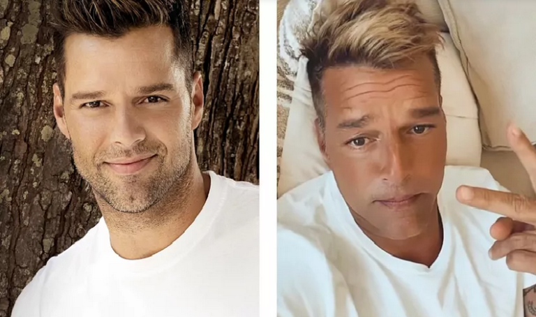 Ricky Martin y su retoque facial que se hace viral: ¡No parece él!