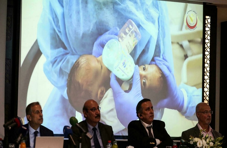 Dos bebés siameses separados con éxito tras compleja operación en Jordania