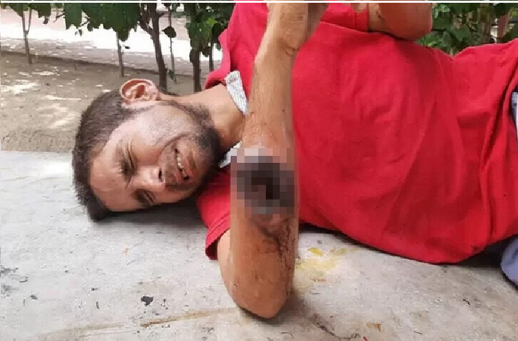 Venezolano fue encontrado herido e inconsciente en las calles de Santa Marta