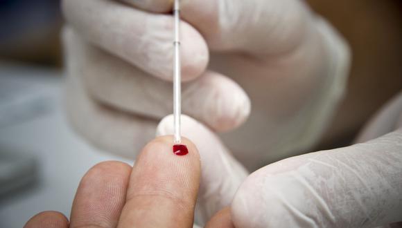 Una mujer es la segunda persona del mundo que se habría curado de VIH por inmunidad natural
