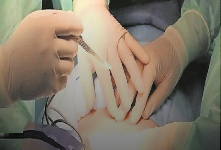 Multan a cirujana que amputó por error  la pierna equivocada a un paciente