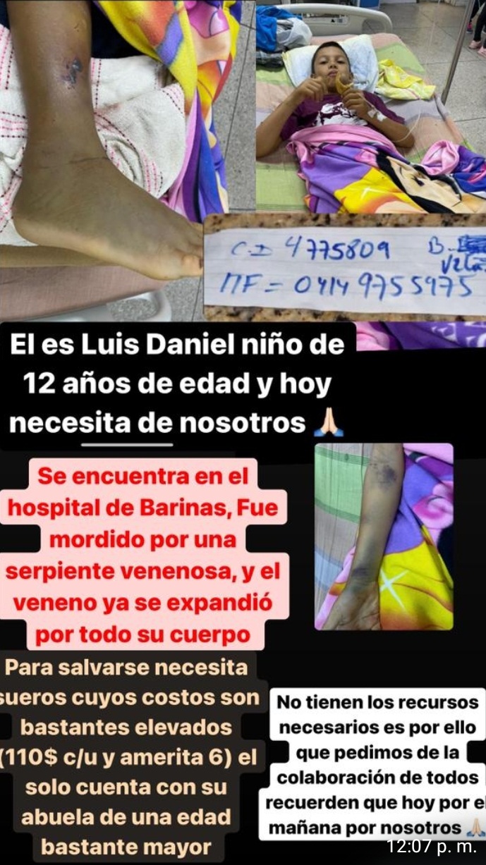 URGENTE: Niño mordido por serpiente en Barinas necesita suero antiofídico