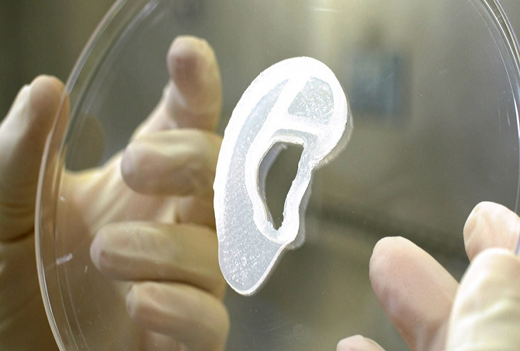 Implantan en paciente oreja impresa a partir de células humanas