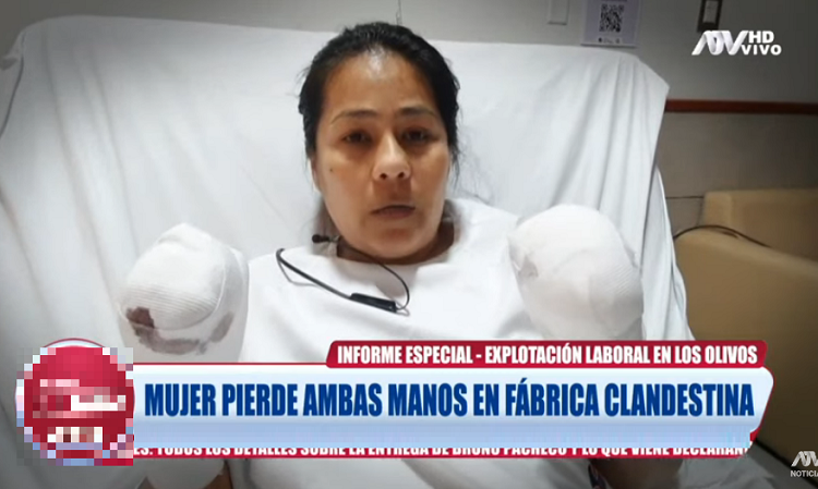 Venezolana perdió ambas manos en fábrica clandestina y revela que le “pusieron precio” a sus extremidades 