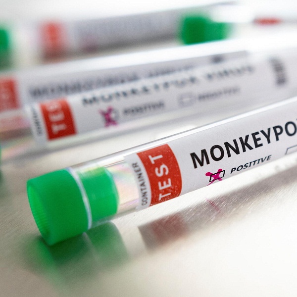 «Limite sus parejas sexuales», aconseja la OMS para contener la viruela del mono