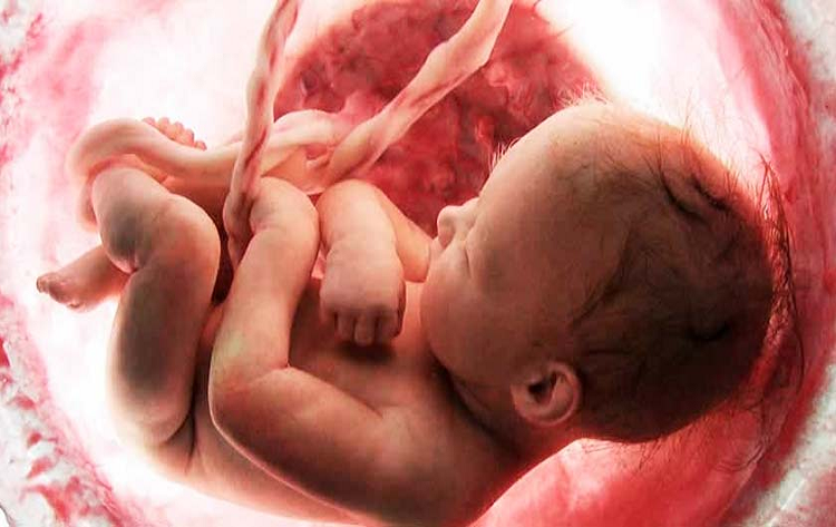 Prohíben a una madre embarazada abortar un feto sin cabeza