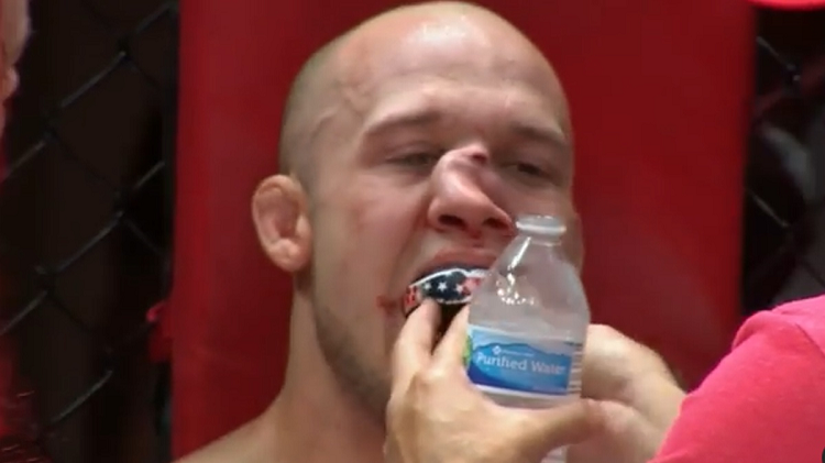 Video| Blake Perry termina con la nariz desfigurada tras pelea de MMA