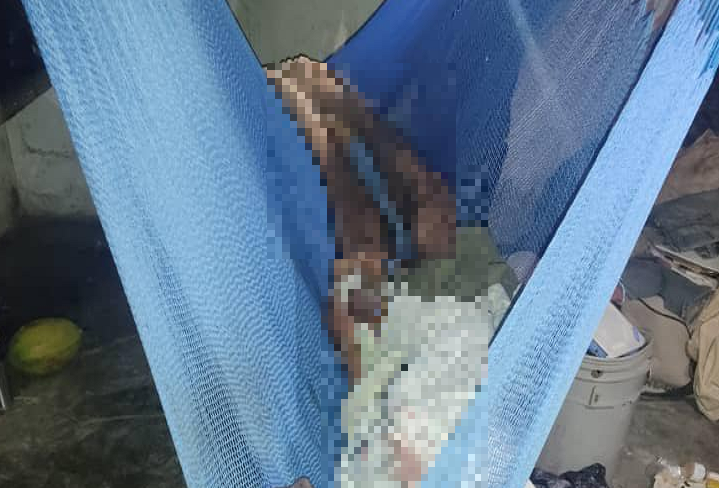 Asesinan a zuliano a tiros mientras dormía en su hamaca en Mauroa